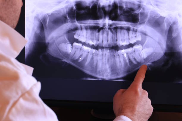 Best Emergency Treatment for Toothache in Clendon, AR