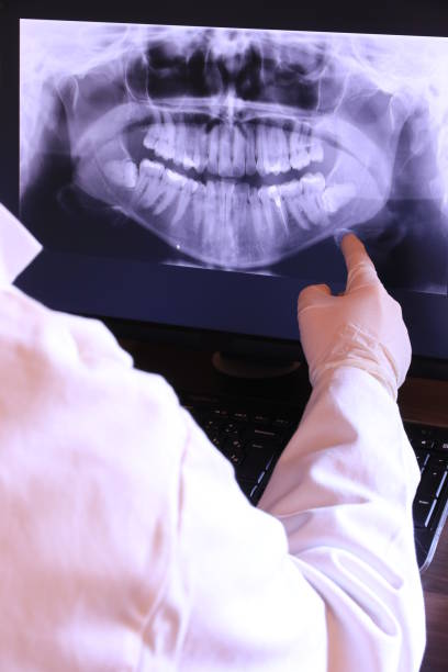 Best Emergency Root Canal Treatment in Clendon, AR