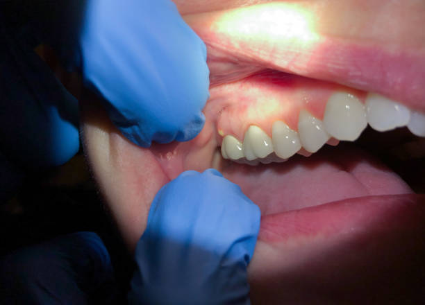 Best After-Hours Emergency Dentist in Clendon, AR